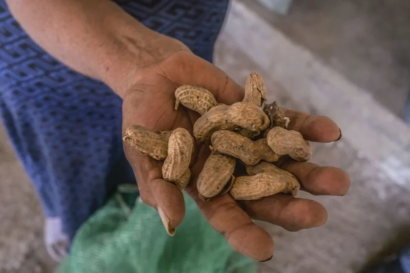 Peanut Allergy Symptoms Reduced in Toddlers with Skin Patch Treatment.