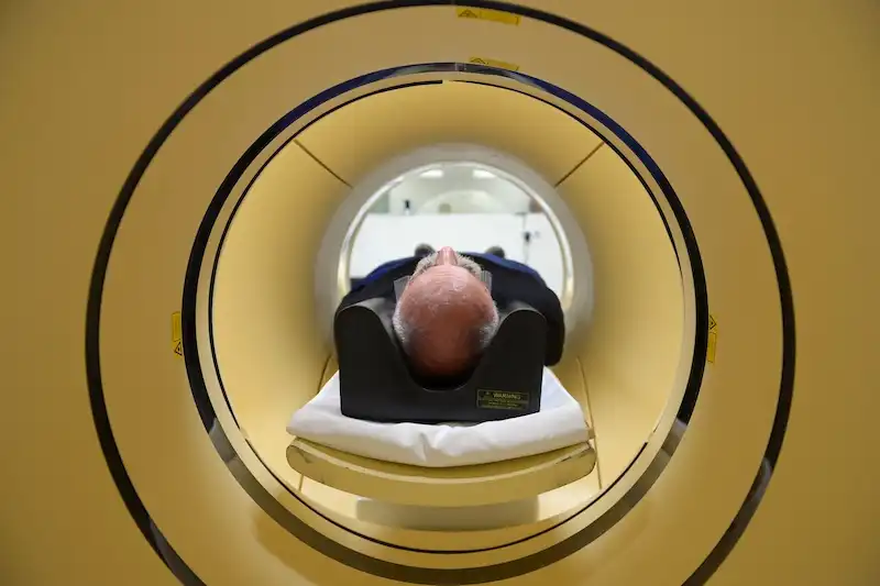 La battaglia contro l'Alzheimer sta raggiungendo una fase cruciale