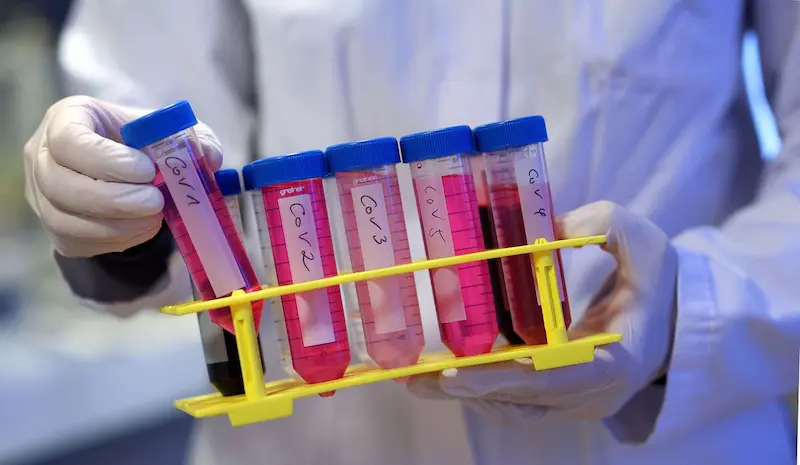 Un nuovo studio rivela il collegamento tra sintomi intestinali e neurologici nel Covid lungo