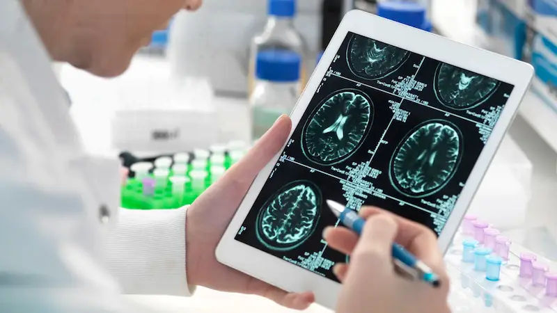 Unearthing Potential Alzheimer's Transmission in Recipients of Discontinued Treatment