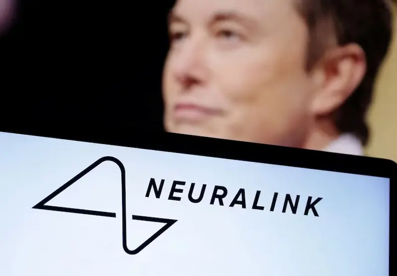 Neuralink Transforms Human Brain with Implantation of First-ever Brain Chip