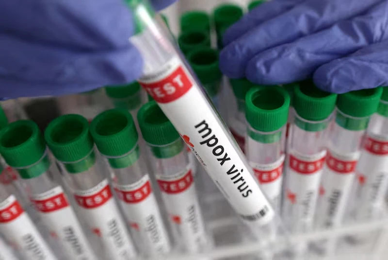 WHO Chief Urges Global Cooperation in Combating New Mpox Outbreak