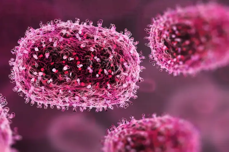 Primera U. S. Caso de nueva forma de Mpox confirmado en viajero de California