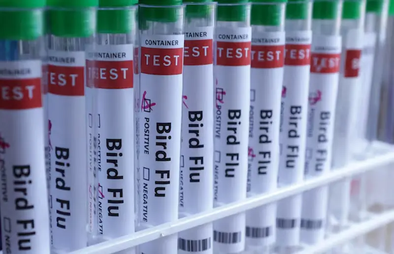 Pierwszy ludzki przypadek Meksyku ptasiej grypy H5N1 wykryty w trzech latach